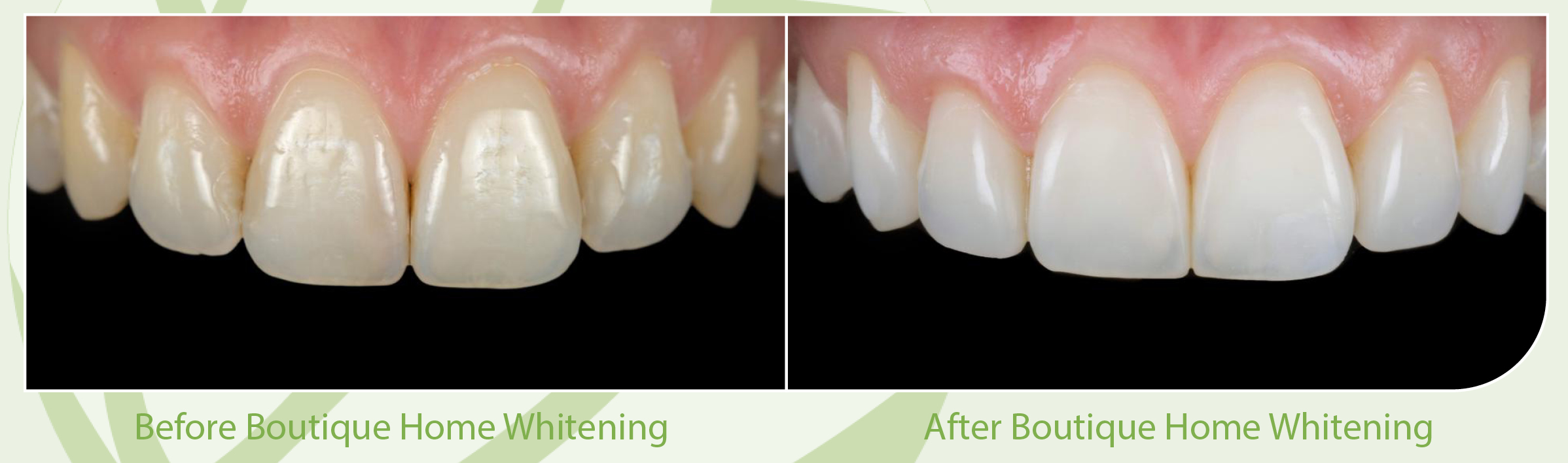 Boutique Whitening Skegness